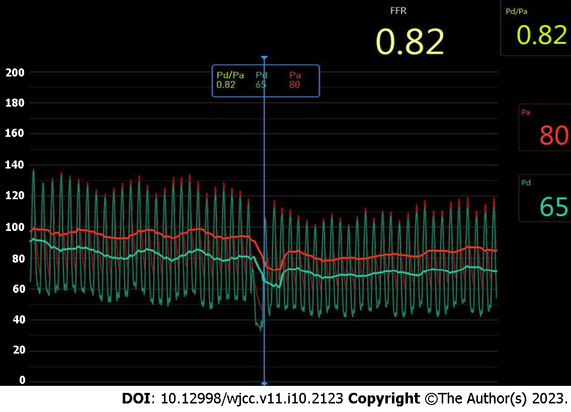 Re Protocol 92% combined ratio chart